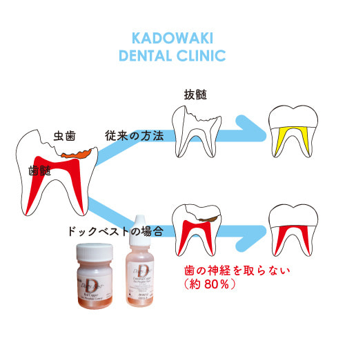 ドックベストセメント